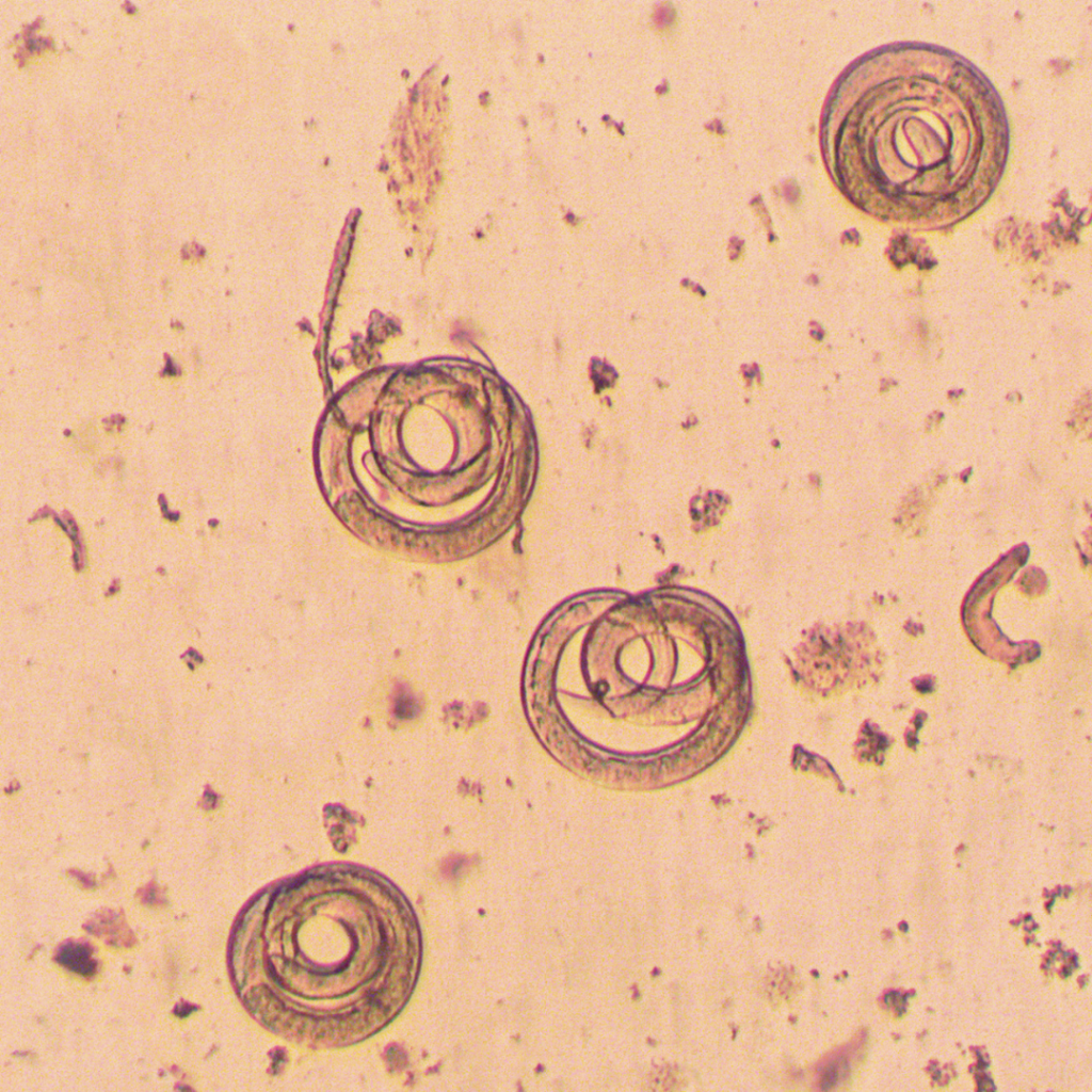 Could You Have a Parasite Without Realizing It?